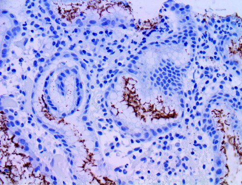 Helicobacter pylori Antibody Immunohistochemistry EP279 on an FFPE Infected Stomach Tissue